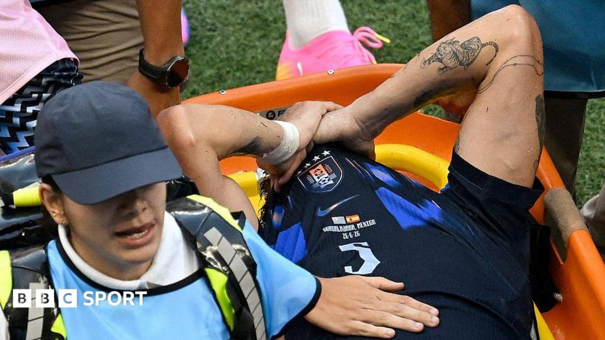 أوغارتي يواجه «أخطر إصابة في مسيرة لاعب كرة»